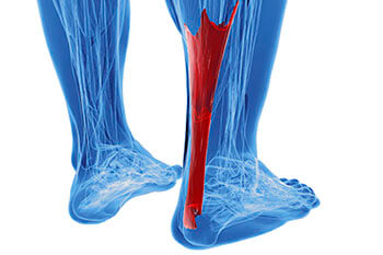 Achilles tendonitis treatment in the Brooklyn, NY 11229 and Astoria, NY 11103 areas